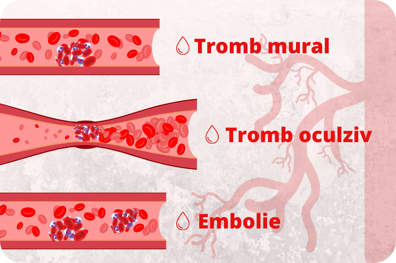tromboza, trombofilie