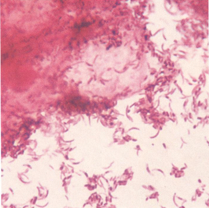 Examen microscopic pe frotiu (preparat proaspăt și/sau colorat) - Synevo