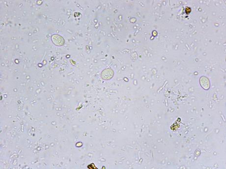 Giardia chisturi