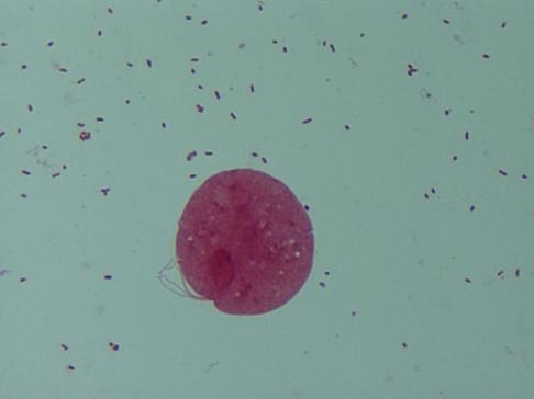 Cultură secreții vaginale (cu antibiogramă după caz) - Synevo