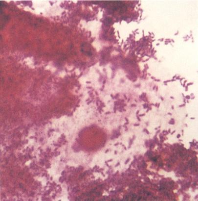 Examen microscopic pe frotiu (preparat proaspăt și/sau colorat) - Synevo