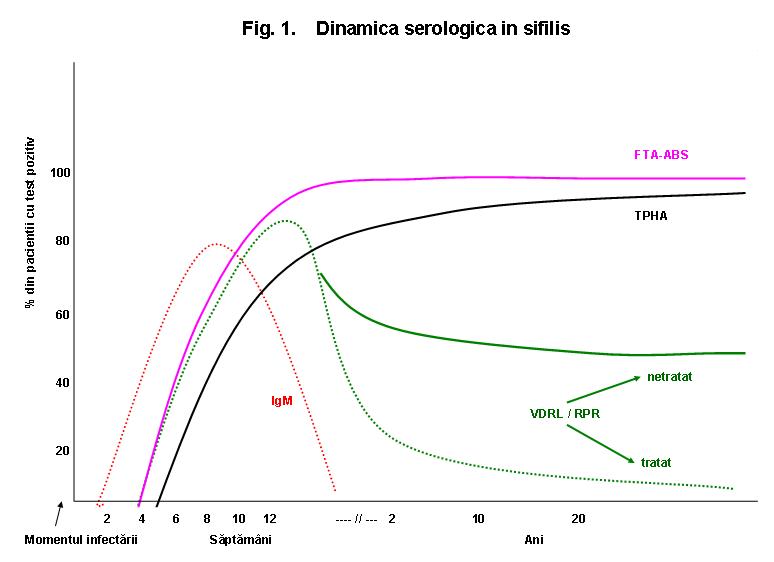 sifilis