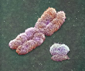 Microdeleții braț lung cromozom Y (AZFa, AZFb, AZFc) - Synevo