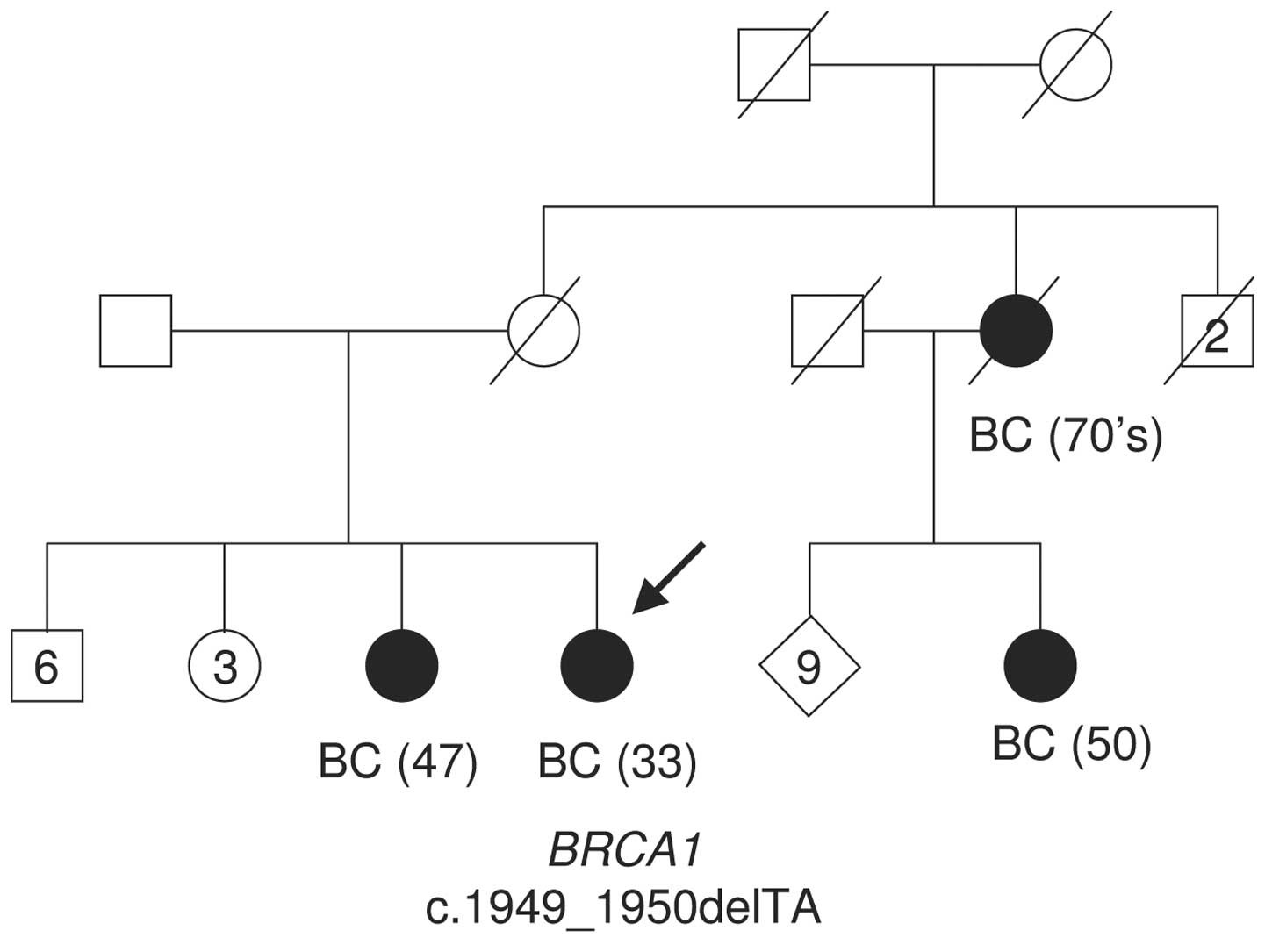 Cancerul ereditar de sân și ovar (HBOC) și testarea mutațiilor în genele BRCA1 și BRCA2 - Synevo