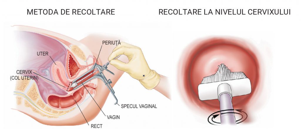 papanicolau