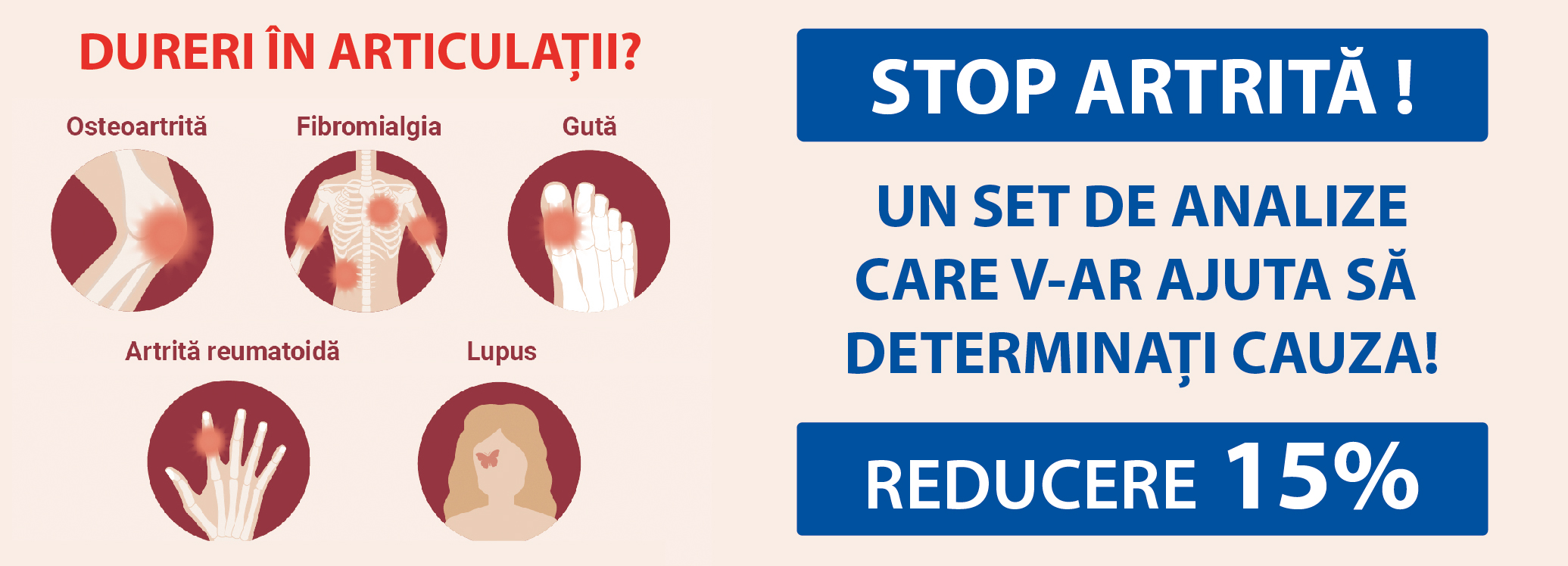 Factor Reumatoid IgA, IgM | siloscordoba.ro