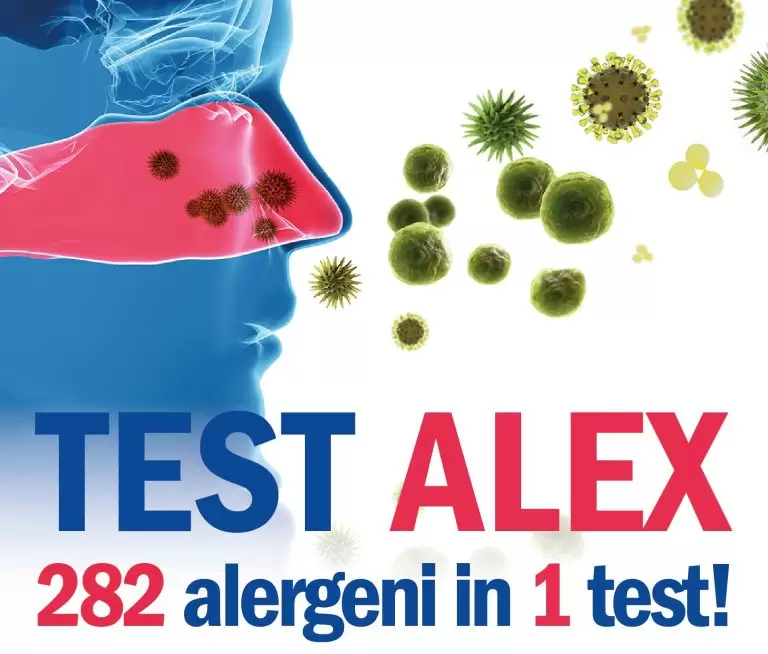 Profil extins IgE specifice (allergy Explorer) – ALEX2 - Synevo